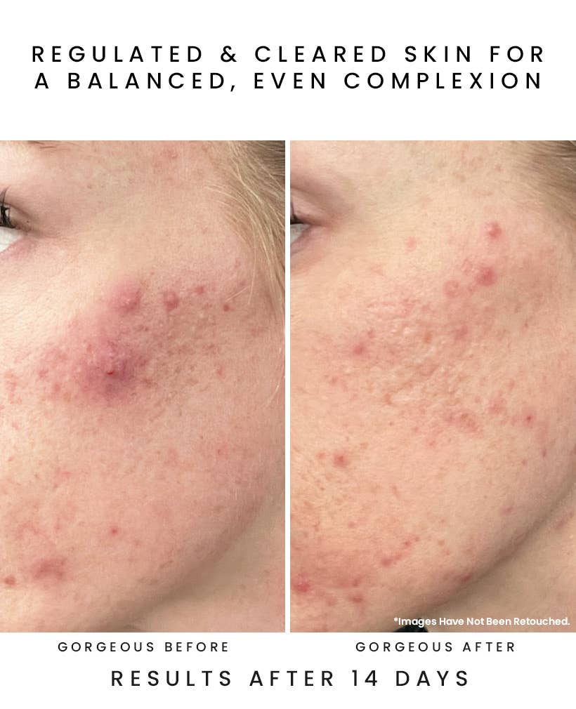 GLOW JUICE 10-Acid Refining Peel: Fruit AHA/BHA